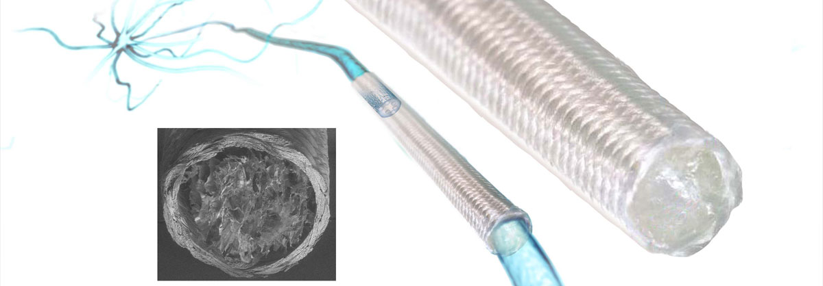Nerbridge is the non-constricting, flexible way to repair peripheral nerve injuries.